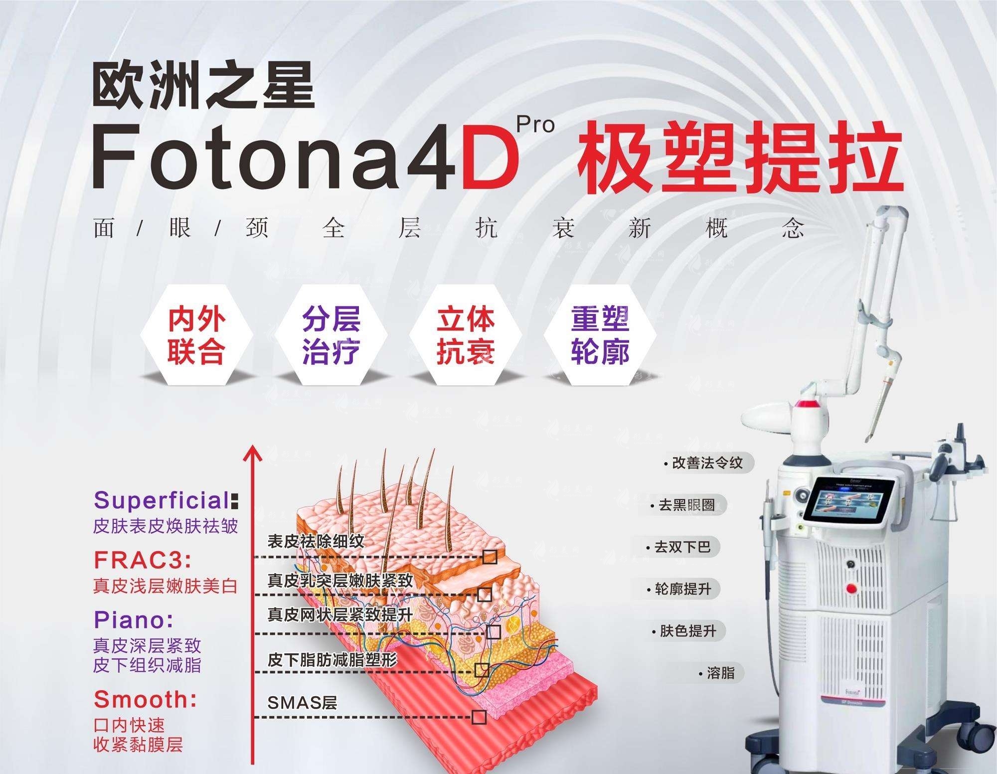 fotona4d做一次维持多久？做完fotona4d需要注意什么？