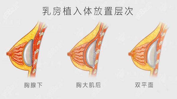 揭晓南京夏建军和黄名斗哪个技术好？假体隆胸参考价格优势在线预约！