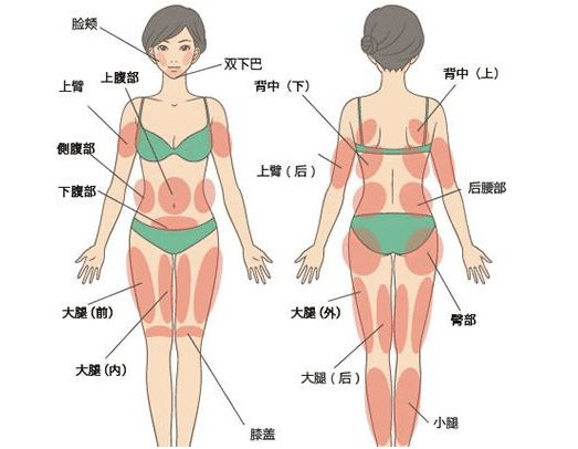 全身吸脂多少钱