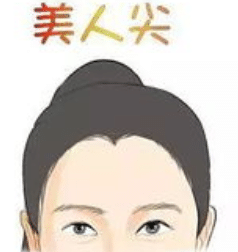 美人尖