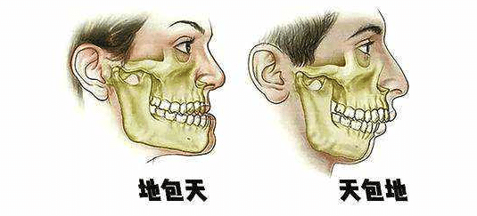 天包地图片