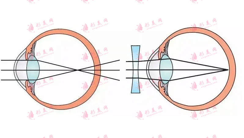 上海市第一人民医院做近视手术怎么样？擅长项目|价格表