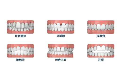 牙齿矫正