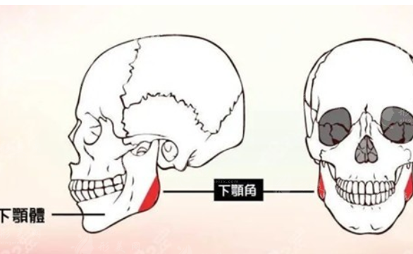 下颌角整形手术危险吗？来详细讨论下