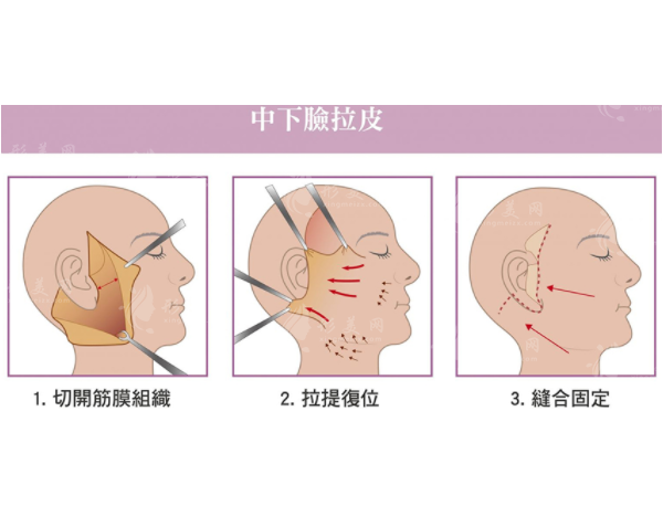 北京京城皮肤医院王驰拉皮手术多少钱？技术优势，医院地址信息。