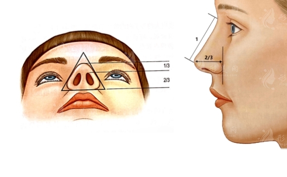 缩鼻头鼻翼需要知道这几件事，别错过！