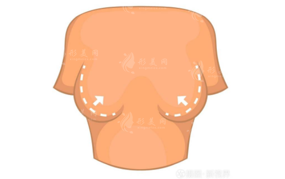 北京八大处整形胸部下垂矫正怎么样？医生资料、项目表一览