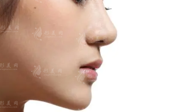 重庆艺星鼻子整形手术，优质医生介绍，案例分享，附价格表