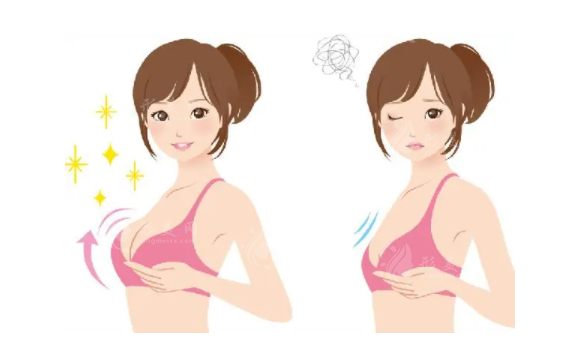 做了脂肪隆胸后可以喂母乳吗？