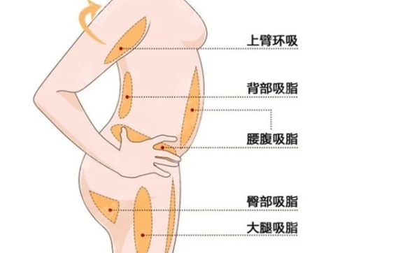 自体脂肪成活率与哪些因素有关