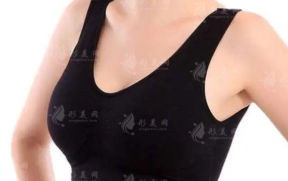 乳晕整形：解读乳晕扩大现象与整形手术