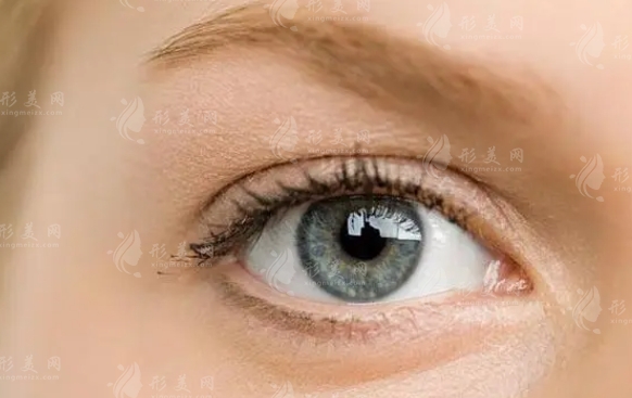 开眼角手术是否会留疤及如何预防瘢痕增生