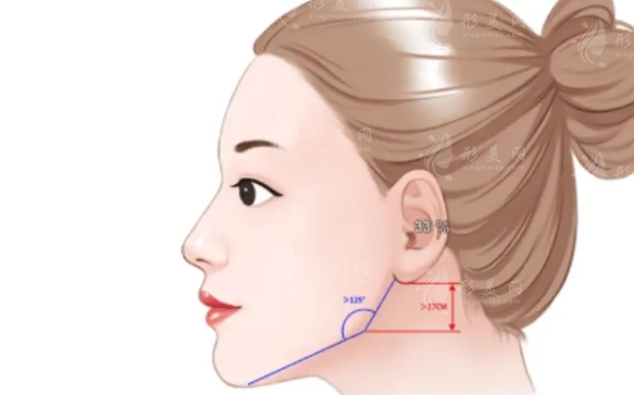 下颌角整形：截骨手术的解析与禁忌人群
