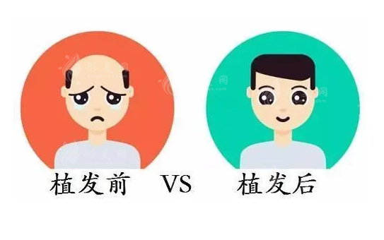 广州市荔湾人民医院植发怎么样？技术卓越，预约便捷，毛囊价格透明