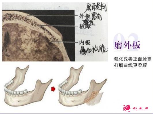 选取医院不同