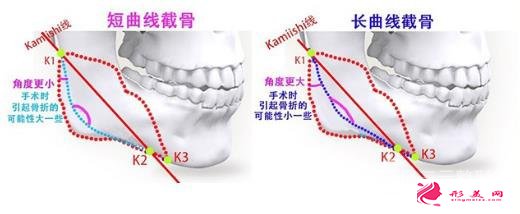 选取医院不同