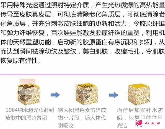 医美小课堂：白瓷娃娃激光功效及效果图