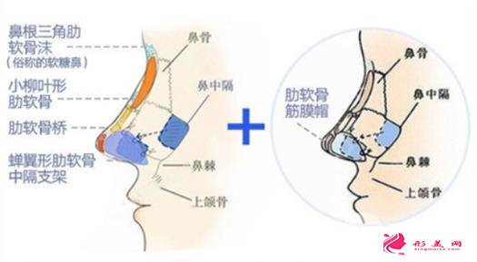 鼻子整形手术后的注意事项