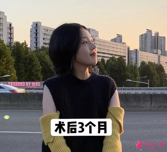 李信锋做鼻子怎么样？看看案例图就知道医生技术了