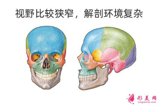 削骨要多少钱?