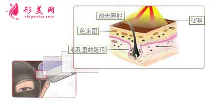 做黑脸娃娃费用多少