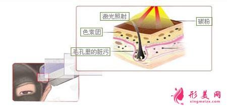 做黑脸娃娃费用多少