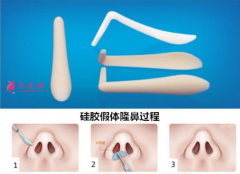 硅胶在鼻部能存放多久？