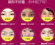 广州美莱做双眼皮的效果怎么样？