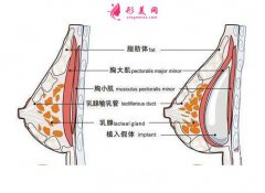 复合型隆胸效果怎么样？优点有哪些？