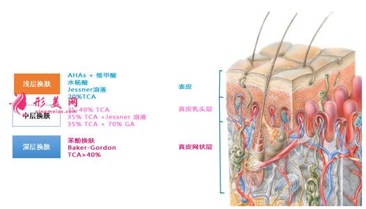 果酸换肤需要多少钱