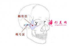 上海整形医院颧骨颧弓内推手术有什么风险吗？