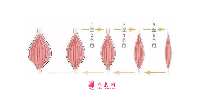 打瘦脸针大概多少钱？瘦脸的原理是什么？