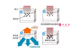 术前科普：激光祛斑多少钱一次？