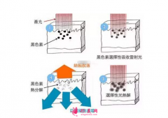 术前科普：激光祛斑多少钱一次？