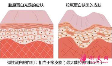 专家科普：怎么去除痘疤？价格是多少？