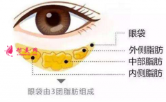 做手术切除眼袋多久恢复好？