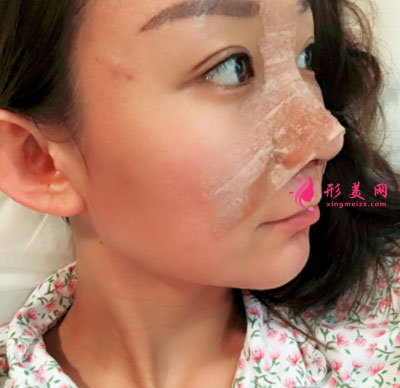 北京美莱医疗美容医院鼻部多项手术案例