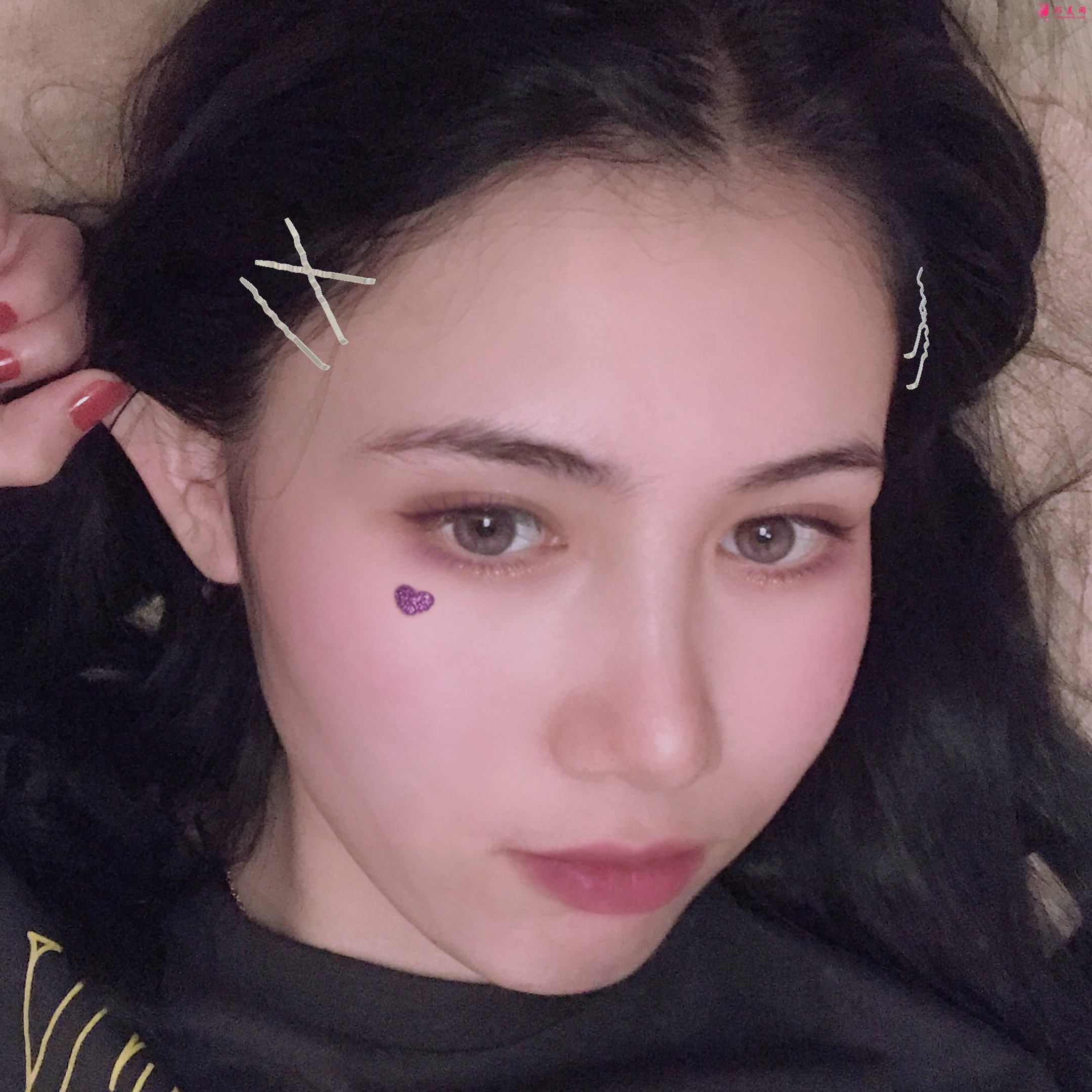 热玛吉术后