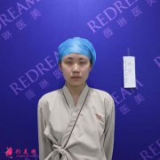 苏州薇琳医疗美容医院隆鼻怎么样？术前术后对比图