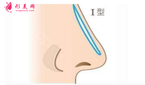 怎样垫高鼻梁