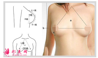 假体隆胸后不对称怎么回事