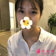 深圳富华医疗美容医院双眼皮案例 我都被自己惊艳了 变美捷径