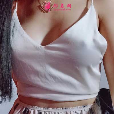 成都美极整形做隆胸术后30天图片