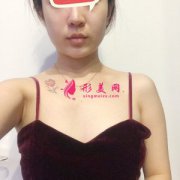 上海华美整形医院做假体隆胸后走上性感路线