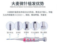 大麦微针植发靠谱吗？微针植发恢复过程日记