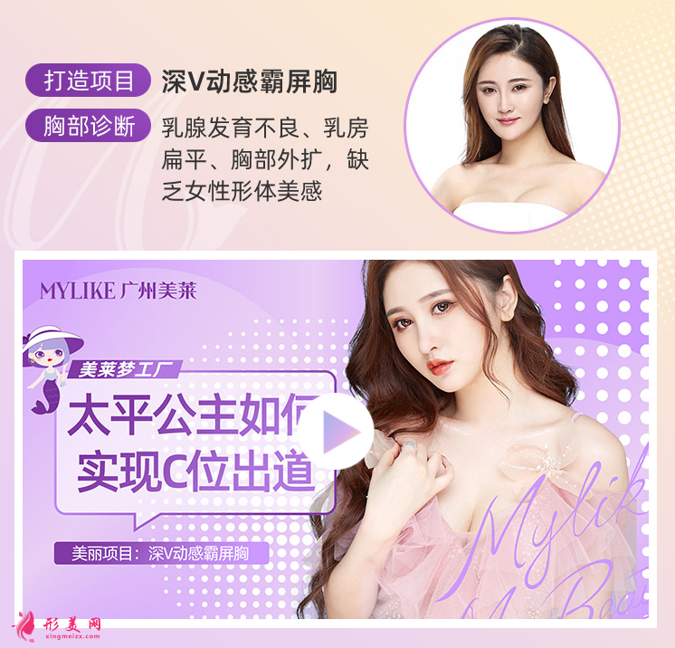 广州美莱深V动感霸屏胸案例图.png